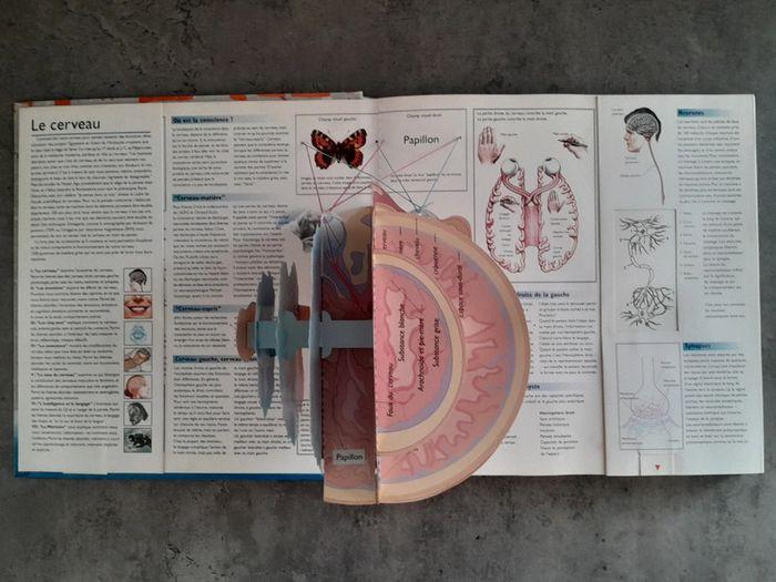 Le cerveau - 3 dimensions 1998 - photo numéro 4